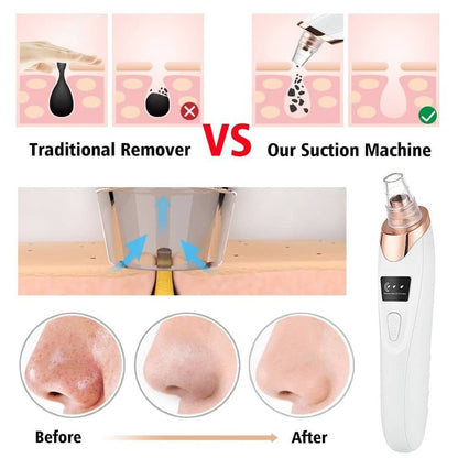 5 in 1 Blackhead remover | Derma Suction  | Rechargeable